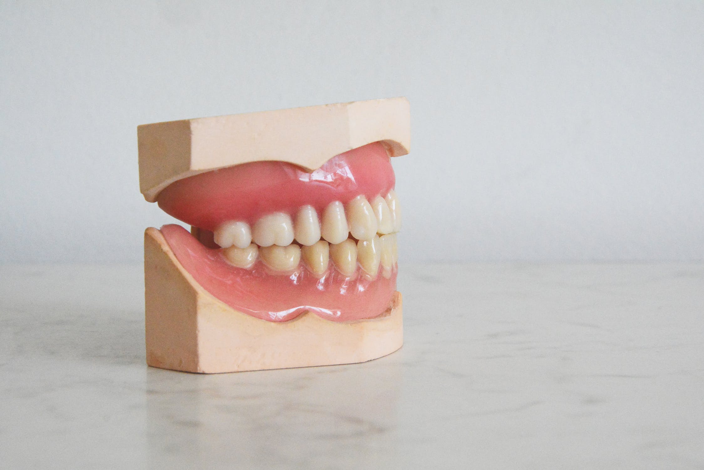 dental implants